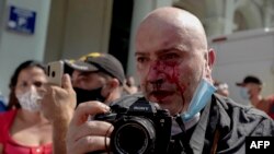 Archivo. El fotógrafo de AP, Ramón Espinosa, fue golpeado mientras cubría la protesta del 11 d ejulio de 2021 en La Habana, contra el gobernante cubano Miguel Díaz-Canel.