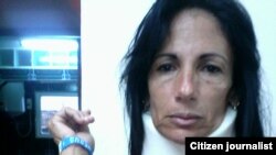 Dama de Blanco muestra agresiones de que fue víctima junto a su hijo