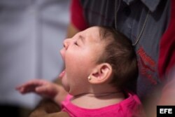 Una bebé con microcefalia recibe atención médica en una clínica de Recife, Brasil.