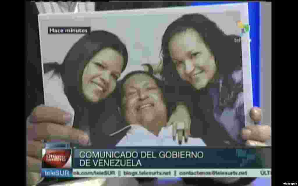 El presidente venezolano, Hugo Ch&aacute;vez, sigue con problemas respiratorios inherentes a la operaci&oacute;n por un c&aacute;ncer que le fue practicada hace m&aacute;s de dos meses en Cuba.